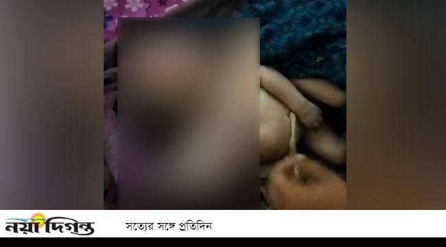 বাগআঁচড়ায় জোড়া মাথার শিশুর জন্ম, দুই ঘণ্টা পর মৃত্যু