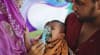 হামের উপসর্গে আরো ৩ শিশুর মৃত্যু, আক্রান্ত ১,১৮৮