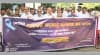 ১০০ বয়স্ক পুরুষে প্রোস্টেট ক্যান্সারের ঝুঁকিতে ৮ জন