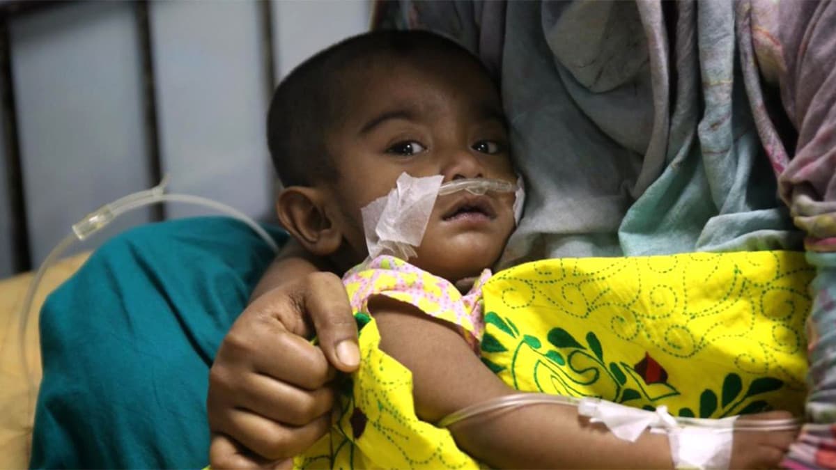 হামের উপসর্গে আরো ৮ শিশুর মৃত্যু, আক্রান্ত ১১৫২